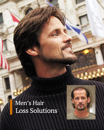 Men's hair loss replacement Pittsburgh Pennsylvania